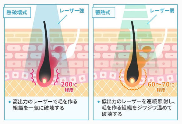 熱破壊式と蓄熱式の違い