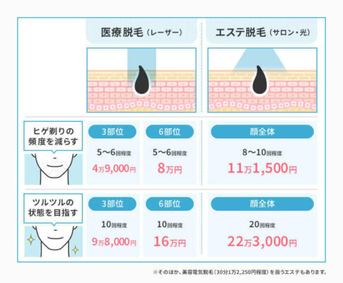 医療脱毛（医療レーザー脱毛）とエステ脱毛（サロン脱毛・光脱毛）の違い