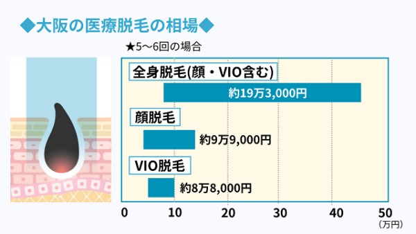 大阪の脱毛料金の相場について